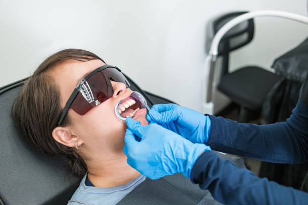Best Teeth Whitening  in Auburn, MI