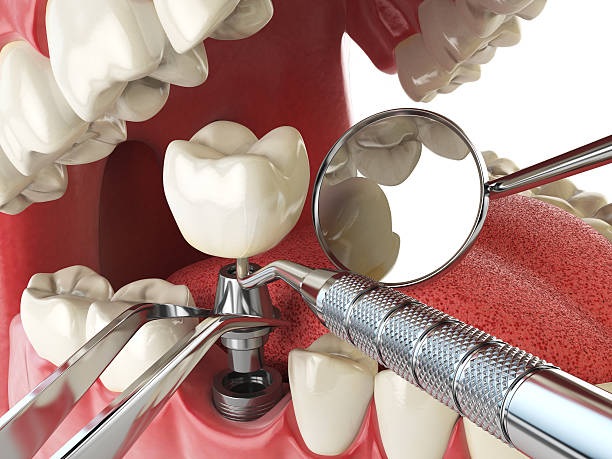 Best Emergency Gum Pain Relief  in Auburn, MI
